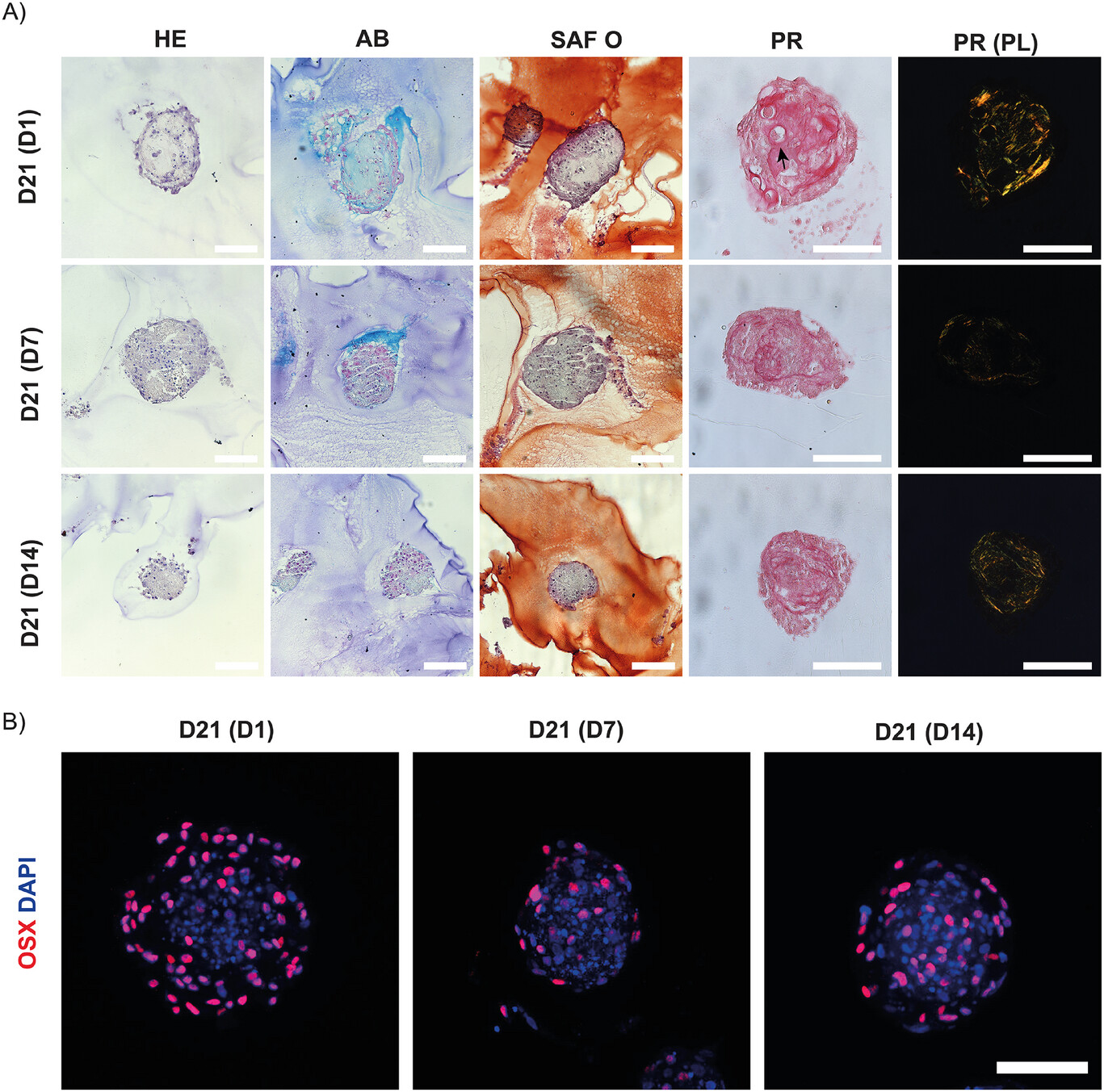 Graphical abstract of the publication entitled  Packed for Ossification: High-Density Bioprinting of hPDC Spheroids in HAMA Toward Endochondral Ossification   